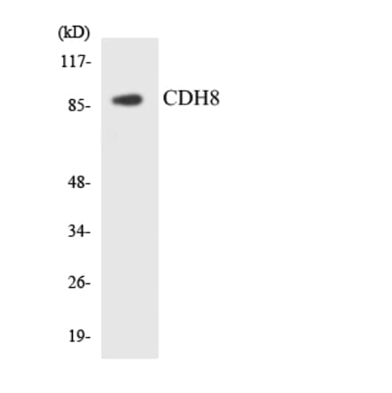 Western Blot - Anti-CDH8 Antibody (R12-2602) - Antibodies.com