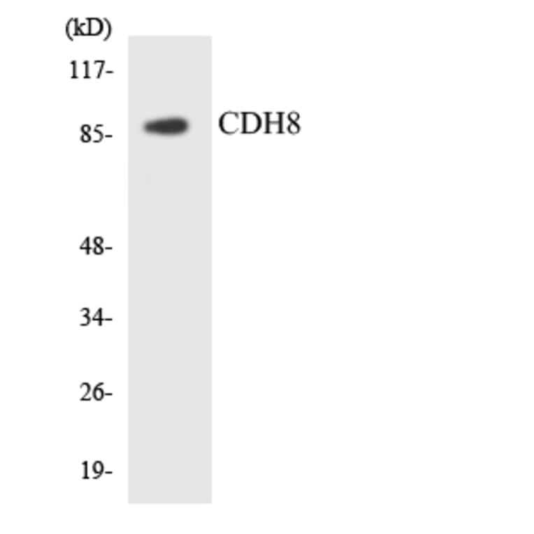 Western Blot - Anti-CDH8 Antibody (R12-2602) - Antibodies.com