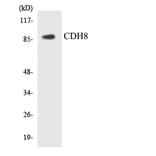 Western Blot - Anti-CDH8 Antibody (R12-2602) - Antibodies.com