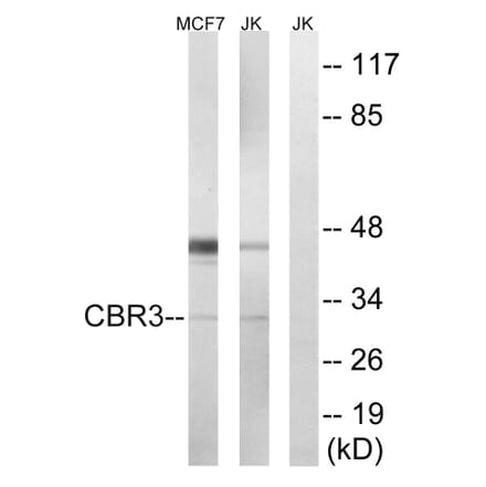 Western Blot - Anti-CBR3 Antibody (C14950) - Antibodies.com