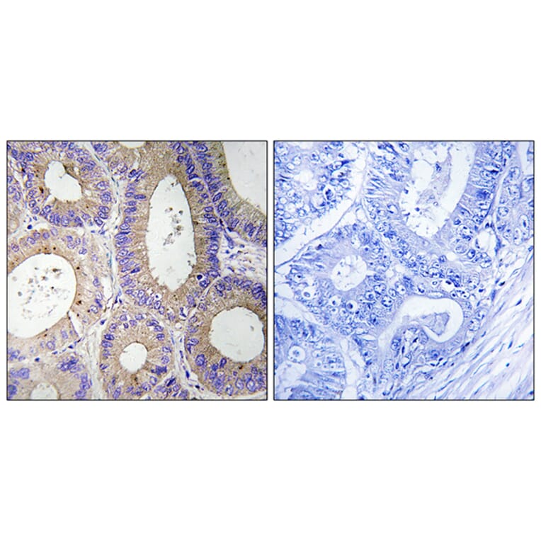 Immunohistochemistry - Anti-CBR3 Antibody (C14950) - Antibodies.com