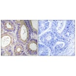 Immunohistochemistry - Anti-CBR3 Antibody (C14950) - Antibodies.com