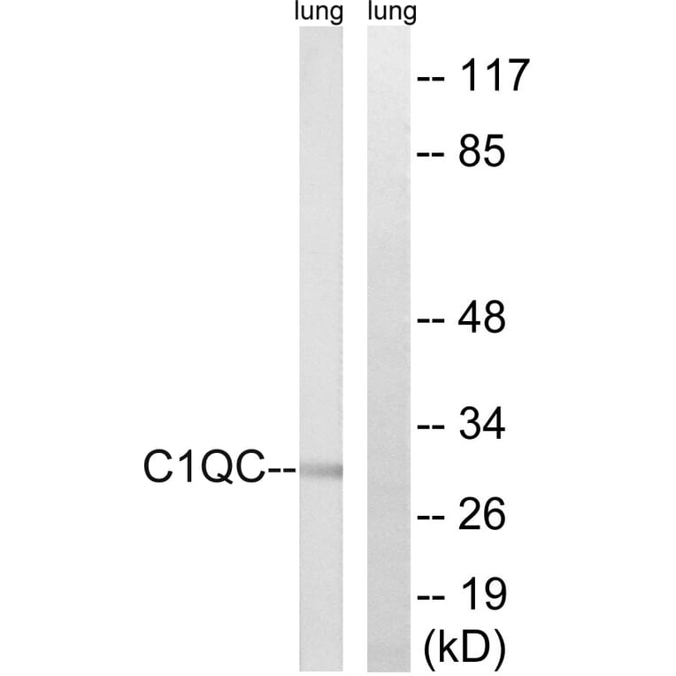 Western Blot - Anti-C1QC Antibody (C15197) - Antibodies.com