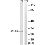 Western Blot - Anti-C1QC Antibody (C15197) - Antibodies.com