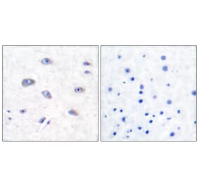 Immunohistochemistry - Anti-BACE Antibody (B0052) - Antibodies.com