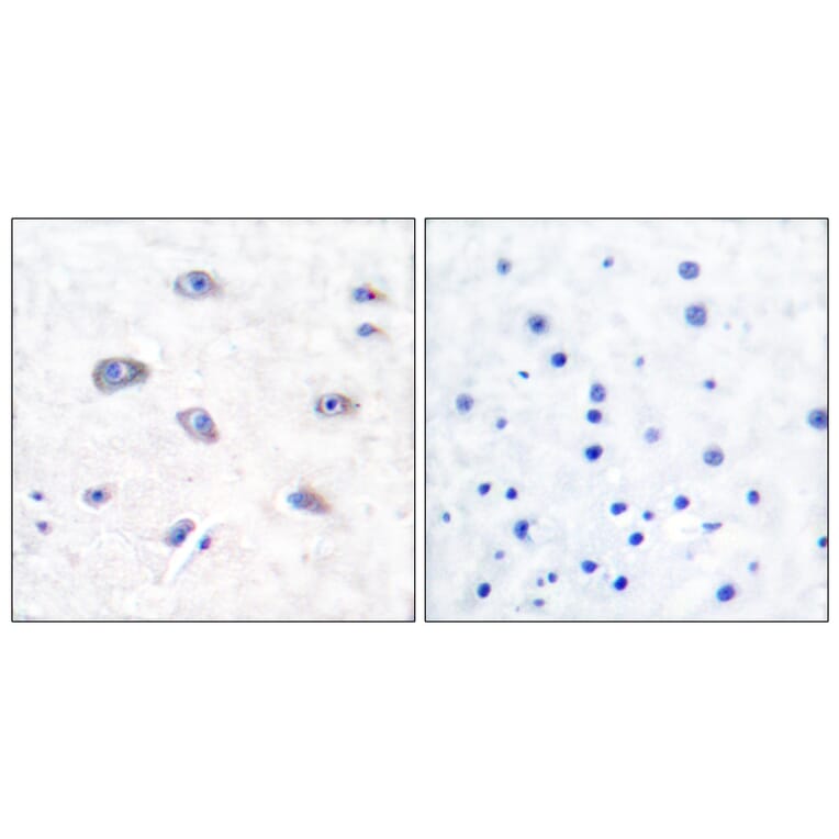 Immunohistochemistry - Anti-BACE Antibody (B0052) - Antibodies.com