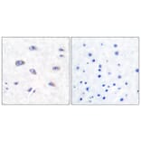 Immunohistochemistry - Anti-BACE Antibody (B0052) - Antibodies.com