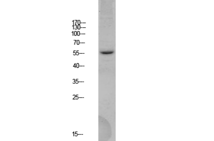 Western Blot - Anti-BACE Antibody (B0052) - Antibodies.com