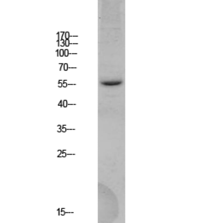 Western Blot - Anti-BACE Antibody (B0052) - Antibodies.com