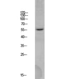 Western Blot - Anti-BACE Antibody (B0052) - Antibodies.com