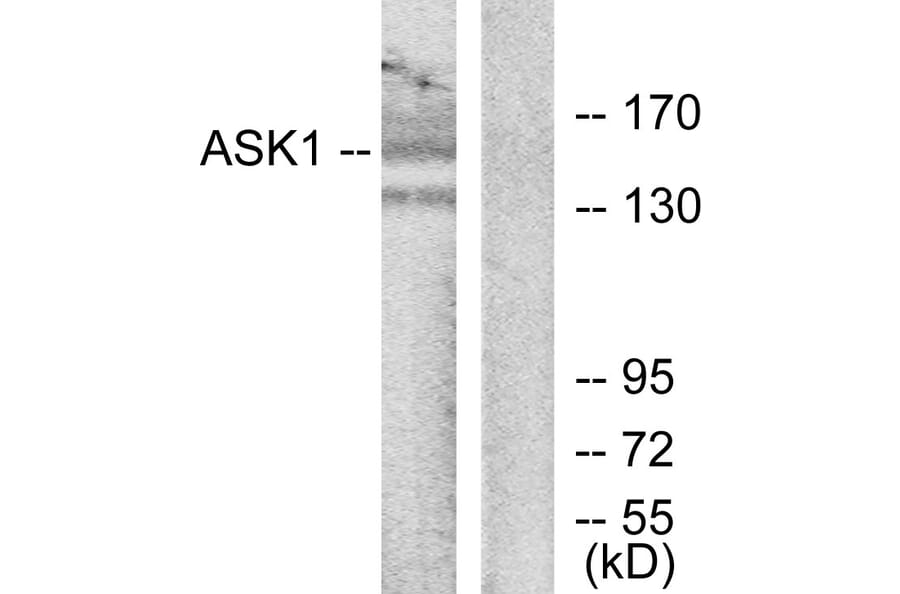 Western Blot - Anti-ASK1 Antibody (B7011) - Antibodies.com