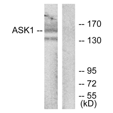 Western Blot - Anti-ASK1 Antibody (B7011) - Antibodies.com