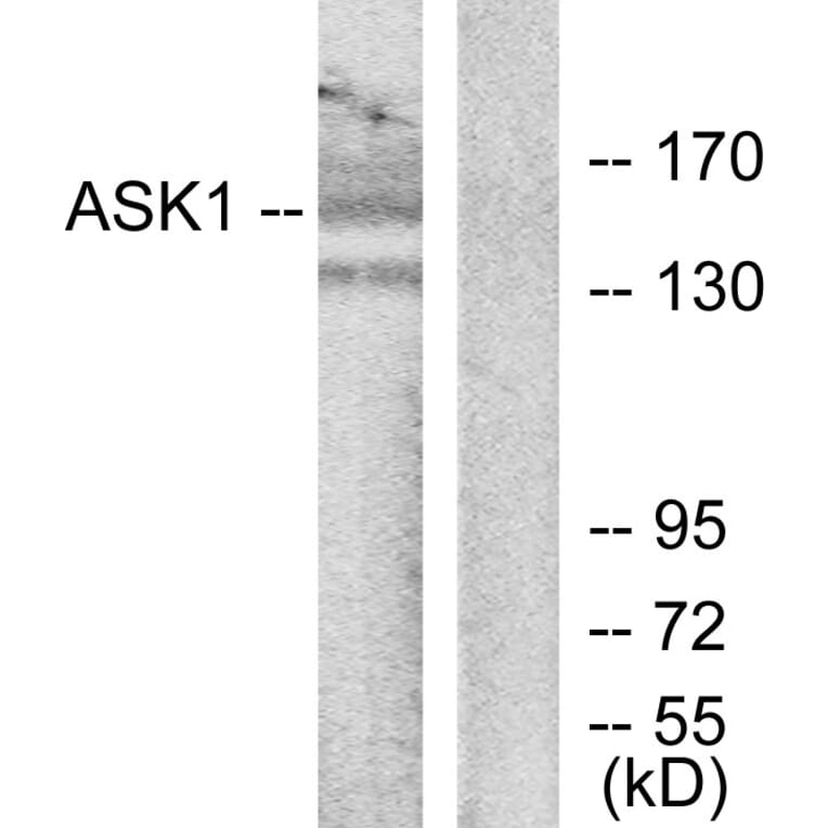 Western Blot - Anti-ASK1 Antibody (B7011) - Antibodies.com
