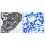Immunohistochemistry - Anti-ASK1 Antibody (B7011) - Antibodies.com