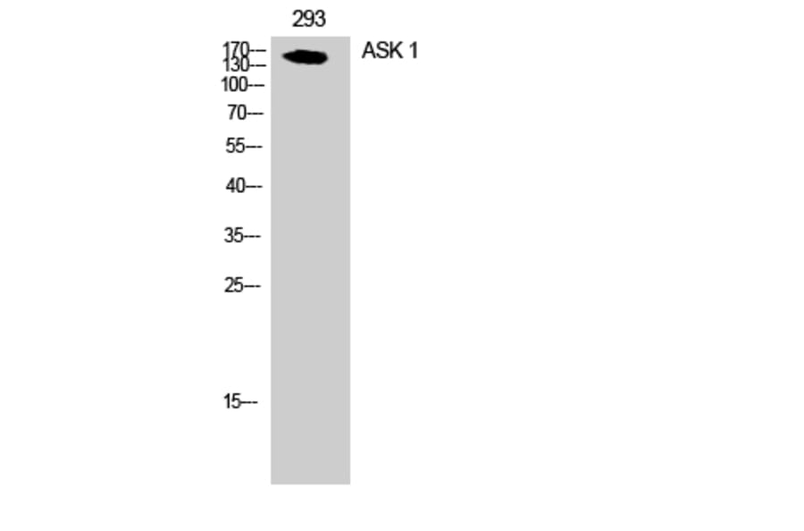 Western Blot - Anti-ASK1 Antibody (B7011) - Antibodies.com