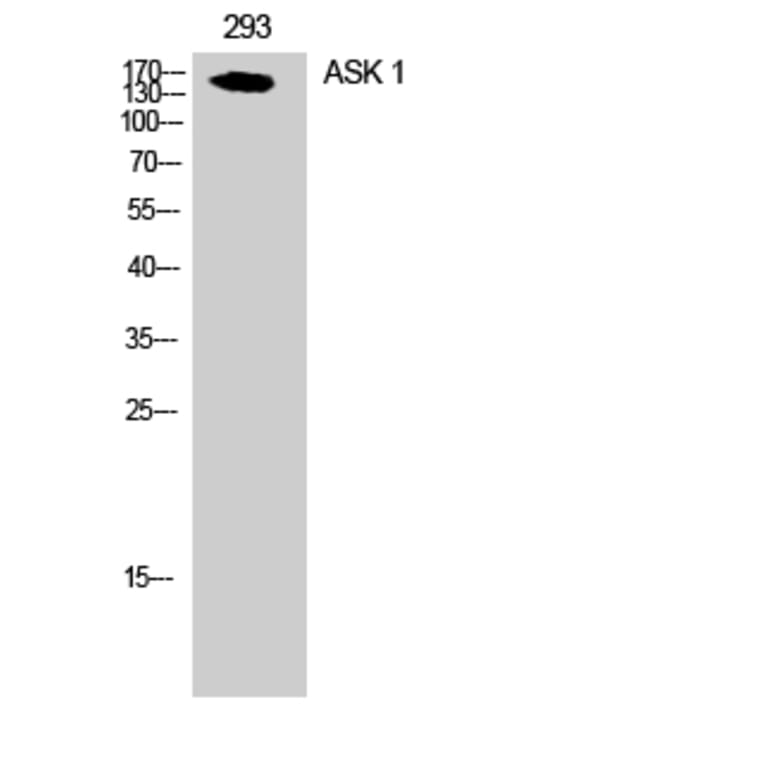 Western Blot - Anti-ASK1 Antibody (B7011) - Antibodies.com