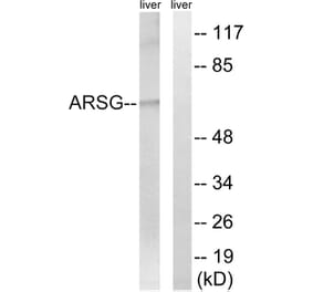Western Blot - Anti-ARSG Antibody (C14569) - Antibodies.com