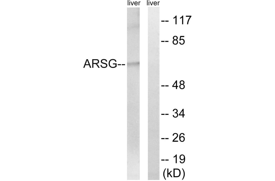 Western Blot - Anti-ARSG Antibody (C14569) - Antibodies.com