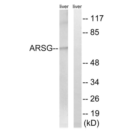 Western Blot - Anti-ARSG Antibody (C14569) - Antibodies.com