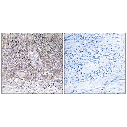 Immunohistochemistry - Anti-ARSA Antibody (C14564) - Antibodies.com