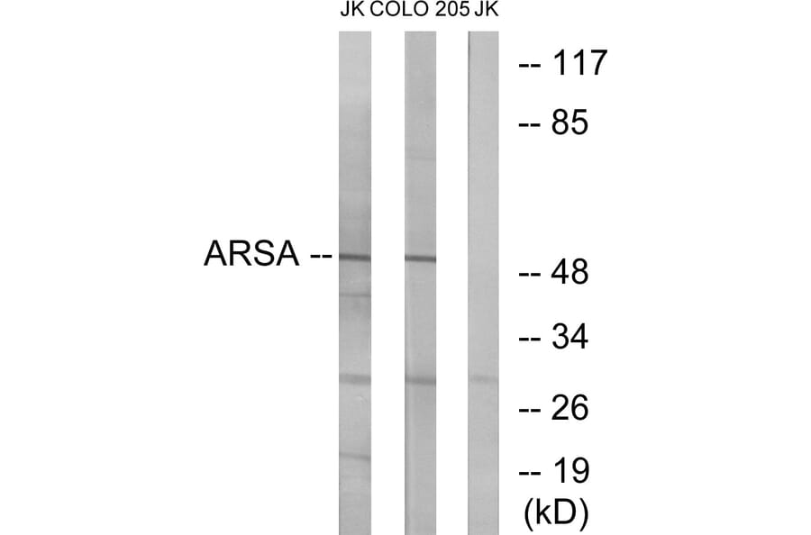 Western Blot - Anti-ARSA Antibody (C14564) - Antibodies.com