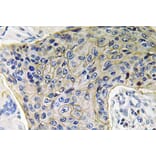 Immunohistochemistry - Anti-AQP4 Antibody (R12-2028) - Antibodies.com