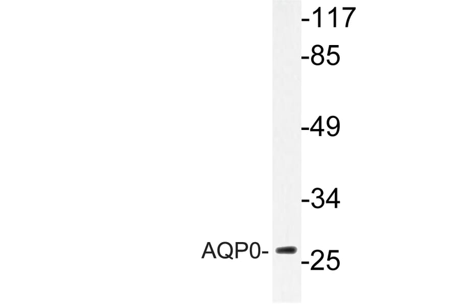 Western Blot - Anti-AQP0 Antibody (R12-2026) - Antibodies.com