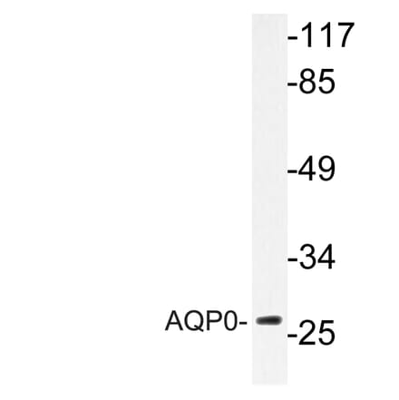 Western Blot - Anti-AQP0 Antibody (R12-2026) - Antibodies.com