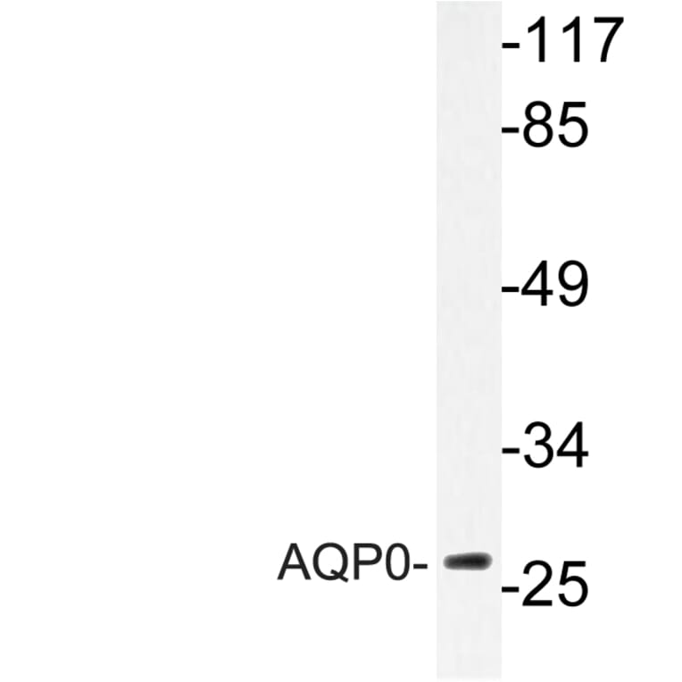 Western Blot - Anti-AQP0 Antibody (R12-2026) - Antibodies.com