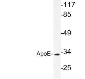 Western Blot - Anti-ApoE Antibody (R12-2025) - Antibodies.com