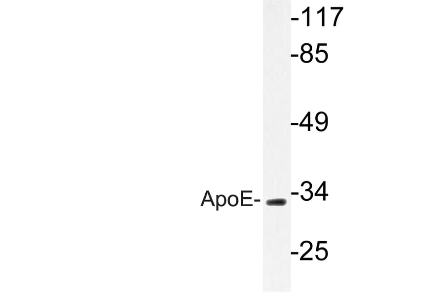 Western Blot - Anti-ApoE Antibody (R12-2025) - Antibodies.com