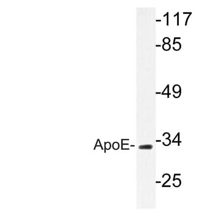 Western Blot - Anti-ApoE Antibody (R12-2025) - Antibodies.com