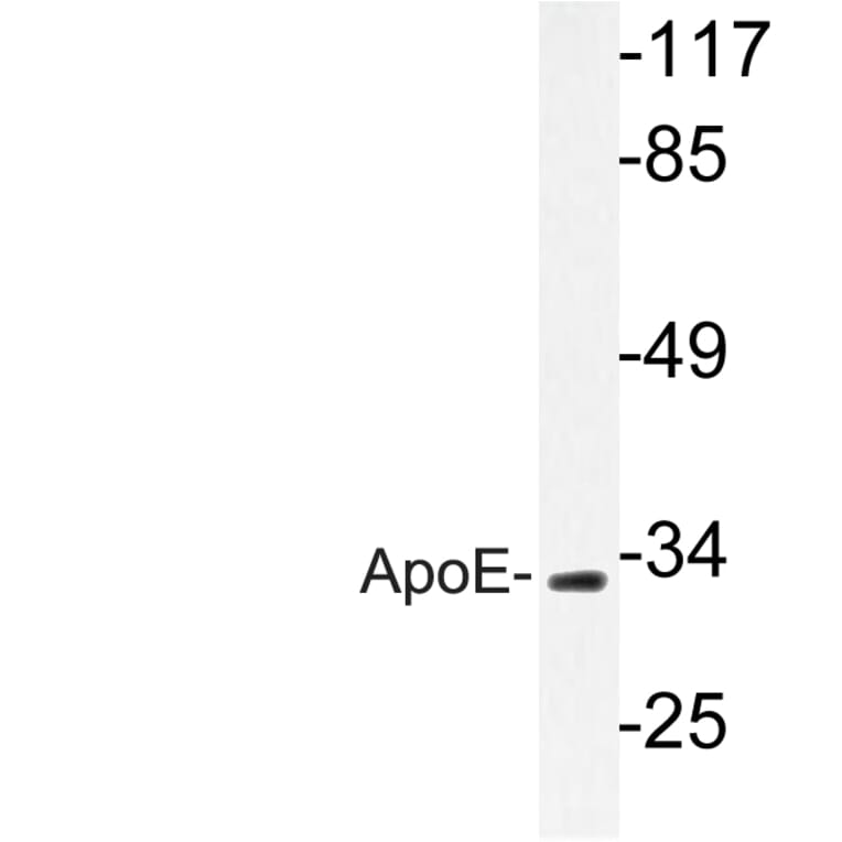 Western Blot - Anti-ApoE Antibody (R12-2025) - Antibodies.com