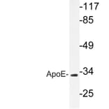 Western Blot - Anti-ApoE Antibody (R12-2025) - Antibodies.com