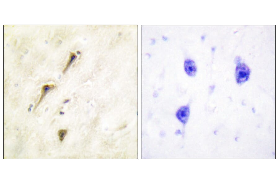 Immunohistochemistry - Anti-APC1 Antibody (B1020) - Antibodies.com