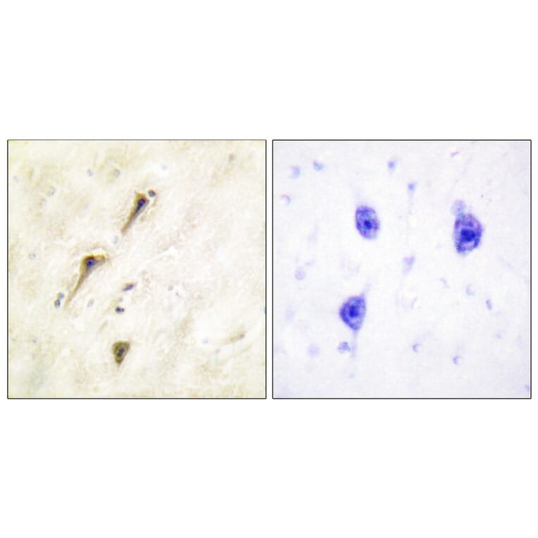 Immunohistochemistry - Anti-APC1 Antibody (B1020) - Antibodies.com