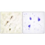 Immunohistochemistry - Anti-APC1 Antibody (B1020) - Antibodies.com