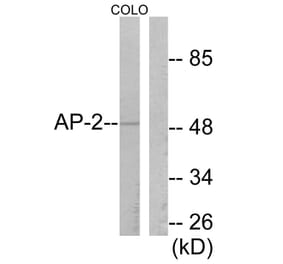Western Blot - Anti-AP-2 Antibody (C0127) - Antibodies.com