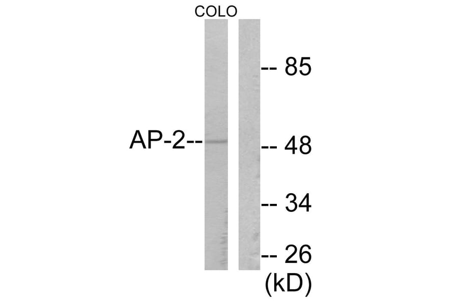 Western Blot - Anti-AP-2 Antibody (C0127) - Antibodies.com