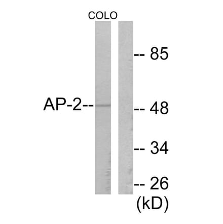 Western Blot - Anti-AP-2 Antibody (C0127) - Antibodies.com