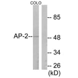 Western Blot - Anti-AP-2 Antibody (C0127) - Antibodies.com