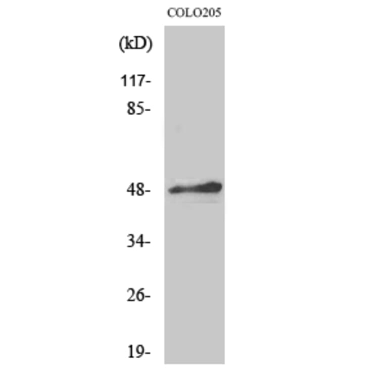 Western Blot - Anti-AP-2 Antibody (C0127) - Antibodies.com