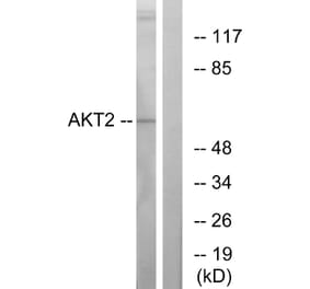 Western Blot - Anti-Akt2 Antibody (B7006) - Antibodies.com