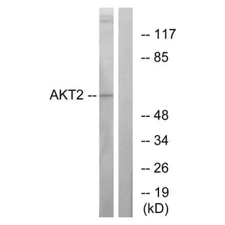 Western Blot - Anti-Akt2 Antibody (B7006) - Antibodies.com