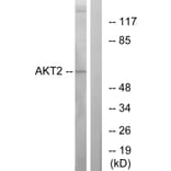 Western Blot - Anti-Akt2 Antibody (B7006) - Antibodies.com