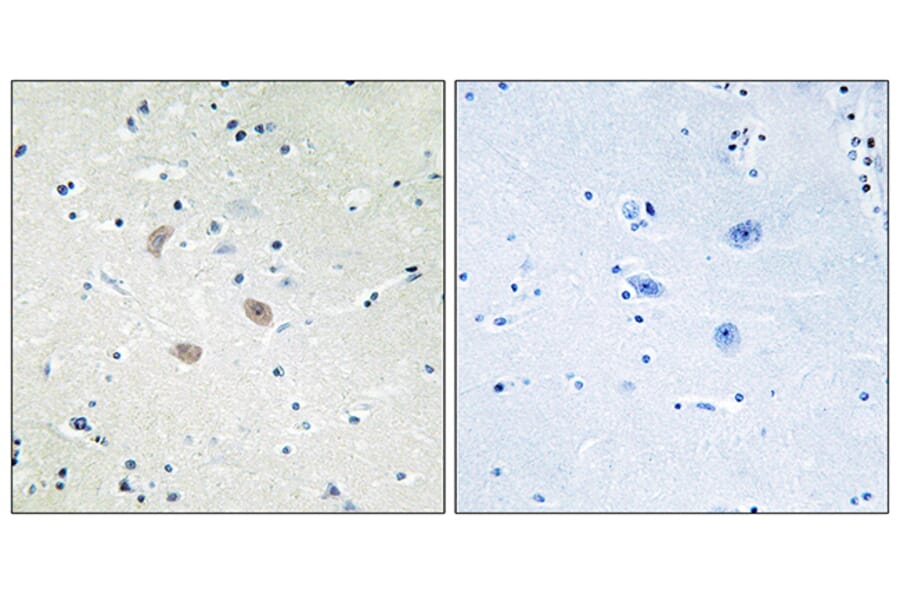 Immunohistochemistry - Anti-Akt2 Antibody (B7006) - Antibodies.com