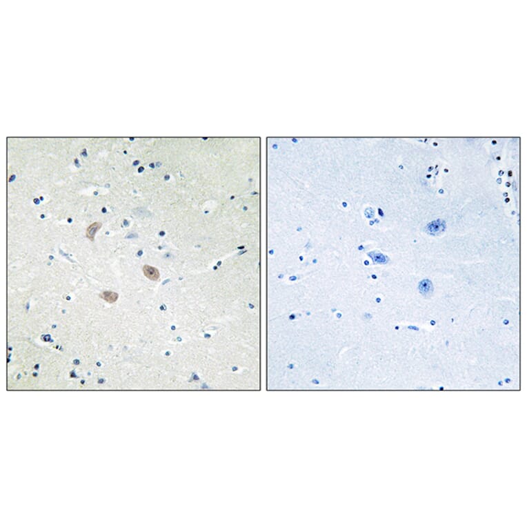 Immunohistochemistry - Anti-Akt2 Antibody (B7006) - Antibodies.com