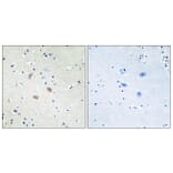 Immunohistochemistry - Anti-Akt2 Antibody (B7006) - Antibodies.com