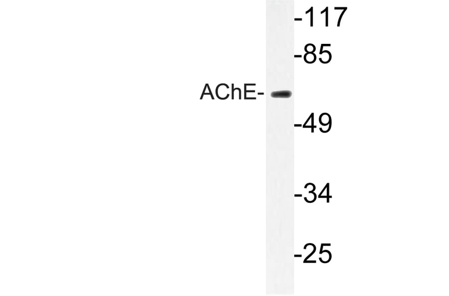 Western Blot - Anti-AChE Antibody (R12-2006) - Antibodies.com
