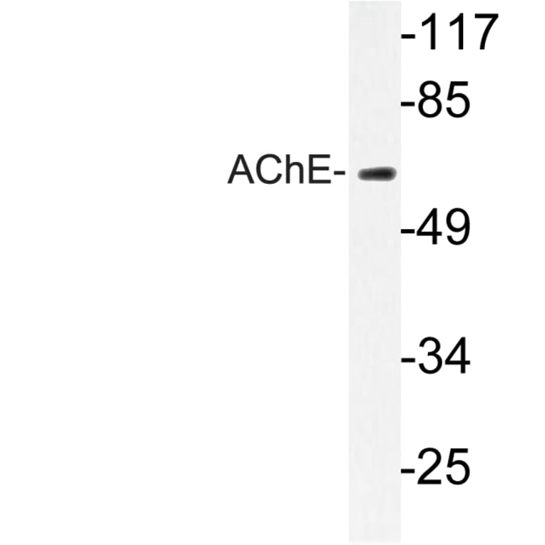 Western Blot - Anti-AChE Antibody (R12-2006) - Antibodies.com